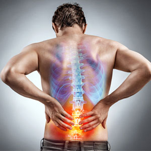 Come prevenire il mal di schiena